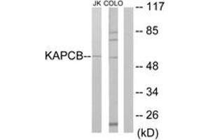 Western blot analysis of extracts from Jurkat/COLO205 cells, using KAPCB Antibody. (PRKACB 抗体  (AA 291-340))