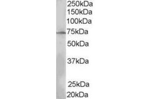 Western Blotting (WB) image for anti-SH2B Adaptor Protein 3 (SH2B3) (N-Term) antibody (ABIN2465907) (SH2B3 抗体  (N-Term))