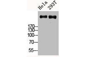 Western Blot analysis of HELA 293T cells using Ki-67 Polyclonal Antibody (Ki-67 抗体  (C-Term))