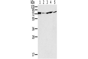 Western Blotting (WB) image for anti-NADH Dehydrogenase (Ubiquinone) Fe-S Protein 1, 75kDa (NADH-Coenzyme Q Reductase) (NDUFS1) antibody (ABIN2430526) (NDUFS1 抗体)