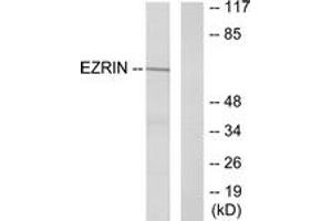 Western blot analysis of extracts from A431 cells, treated with EGF 200ng/ml 30', using Ezrin (Ab-353) Antibody. (Ezrin 抗体  (AA 321-370))