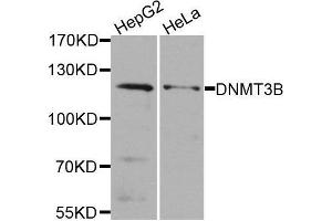 Western blot analysis of extracts of various cell lines, using DNMT3B antibody. (DNMT3B 抗体)