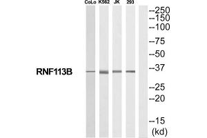 Western Blotting (WB) image for anti-Ring Finger Protein 113B (RNF113B) (Internal Region) antibody (ABIN1852492) (RNF113B 抗体  (Internal Region))