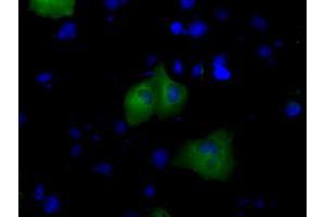 Immunofluorescence (IF) image for anti-Bruton Agammaglobulinemia tyrosine Kinase (BTK) antibody (ABIN1496977) (BTK 抗体)