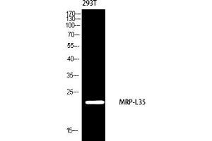 Western blot analysis of 293 using MRP-L35 antibody. (MRPL35 抗体  (AA 80-160))