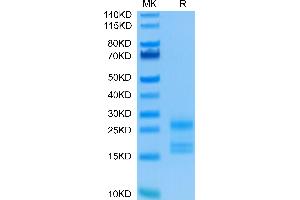 Interleukin 17a Protein (AA 24-155) (His tag)