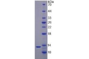 SDS-PAGE (SDS) image for Interleukin 17F (IL17F) ELISA Kit (ABIN6574295)