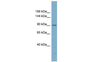 Catenin antibody used at 1 ug/ml to detect target protein. (Catenin 抗体)