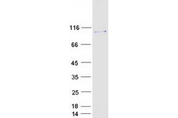 MCC Protein (Transcript Variant 2) (Myc-DYKDDDDK Tag)