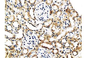 Formalin-fixed and paraffin embedded mouse kidney labeled with Anti-MCP-2 Polyclonal Antibody, Unconjugated (ABIN676283) at 1:200 followed by conjugation to the secondary antibody and DAB staining (CCL8 抗体  (AA 24-99))