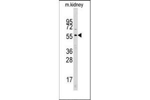 Image no. 1 for anti-Cell Division Cycle 25 Homolog A (S. Pombe) (CDC25A) (N-Term) antibody (ABIN358770) (CDC25A 抗体  (N-Term))