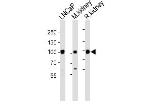 Western blot analysis of lysates from LNCaP, M. (MME 抗体  (N-Term))