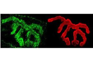 Piccolo Immunofluorescence. (PCLO 抗体)