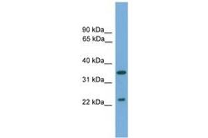 Image no. 1 for anti-WNT Inhibitory Factor 1 (WIF1) (AA 71-120) antibody (ABIN6744960) (WIF1 抗体  (AA 71-120))