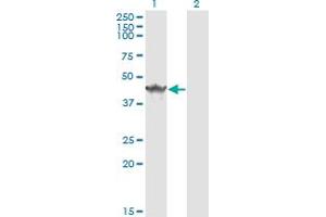 Western Blotting (WB) image for anti-Syndecan Binding Protein (Syntenin) (SDCBP) (AA 1-100) antibody (ABIN562830)