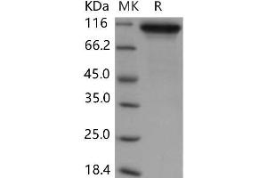 Neuroligin 1 Protein (NLGN1) (His tag)