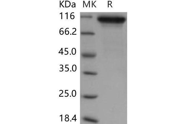 Neuroligin 1 Protein (NLGN1) (His tag)