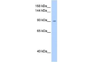 WB Suggested Anti-OSMR Antibody Titration:  0. (Oncostatin M Receptor 抗体  (N-Term))