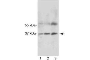 Western blot testing of 1) rat heart, 2) rat skeletal muscle and 3) human MCF7 lysate with MRGX1 antibody. (MRGPRX1 抗体)