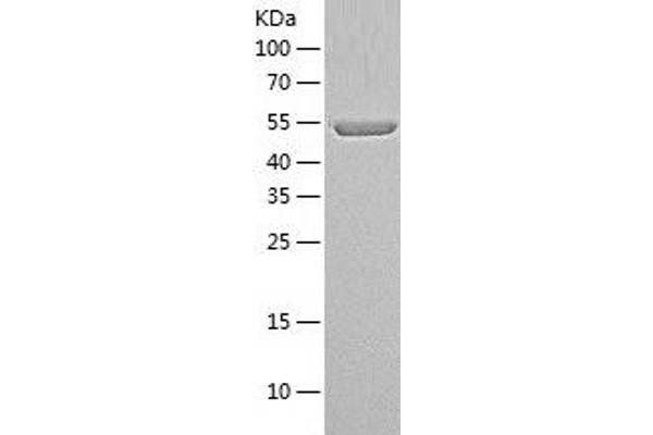 PPIL4 Protein (AA 1-512) (His tag)