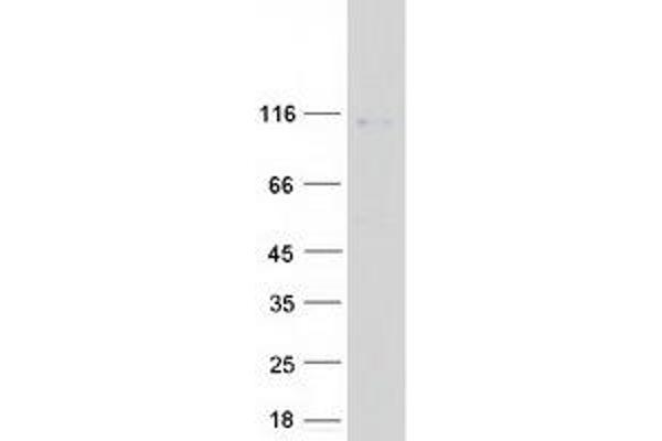 ADAMTS8 Protein (Myc-DYKDDDDK Tag)