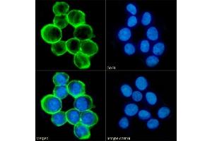 Immunofluorescence staining of fixed K562 cells with anti-CD43 antibody 84-3C1. (Recombinant CD43 抗体)