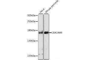 Western blot analysis of extracts of various cell lines using CEACAM5 Polyclonal Antibody at dilution of 1:1000. (CEACAM5 抗体)