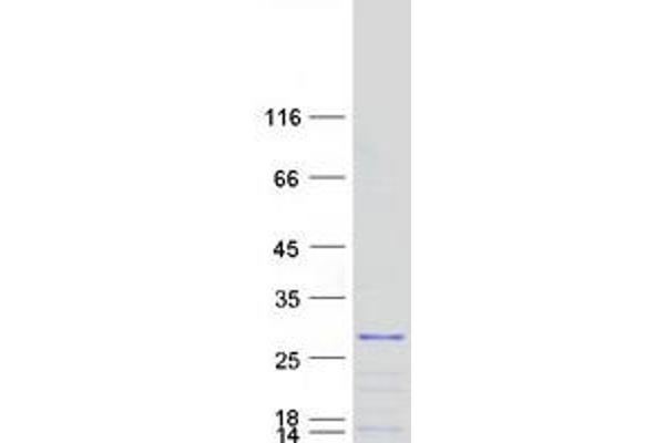 G Substrate Protein (Gsbs) (Transcript Variant 1) (Myc-DYKDDDDK Tag)