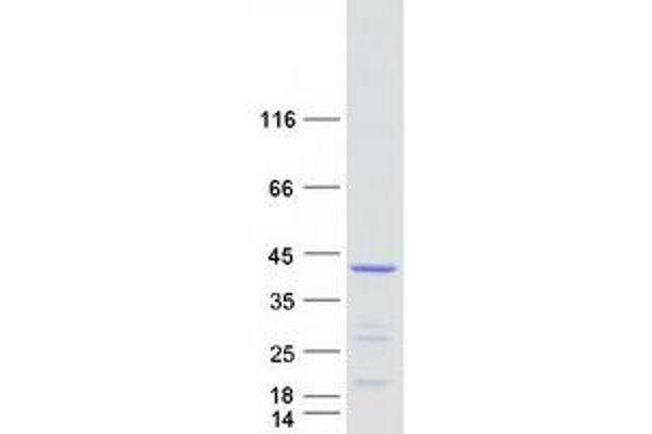 CNN2 Protein (Transcript Variant 1) (Myc-DYKDDDDK Tag)