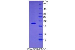 SDS-PAGE (SDS) image for Matrix Metallopeptidase 9 (Gelatinase B, 92kDa Gelatinase, 92kDa Type IV Collagenase) (MMP9) ELISA Kit (ABIN6730931)