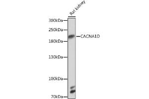 Western blot analysis of extracts of Rat kidney, using CD Rabbit pAb (ABIN7266013) at 1:1000 dilution. (CACNA1D 抗体  (AA 1882-2181))