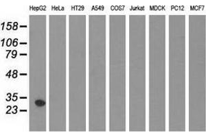 Western blot analysis of extracts (35 µg) from 9 different cell lines by using anti-SULT2A1 monoclonal antibody. (SULT2A1 抗体)