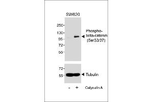 Western blot analysis of extracts from S cells, untreated or treated with Calyculin A, (100nM, 30 min), using Phospho-beta-catenin (Ser33/37) Antibody. (beta Catenin 抗体  (pSer33, pSer37))