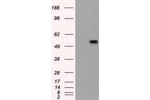 HEK293T cells were transfected with the pCMV6-ENTRY control (Left lane) or pCMV6-ENTRY CD36 (Right lane) cDNA for 48 hrs and lysed. (CD36 抗体)