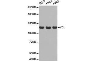 Western Blotting (WB) image for anti-Vinculin (VCL) antibody (ABIN1875315) (Vinculin 抗体)