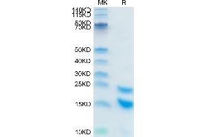 CCL5 Protein (AA 24-91) (His tag,SUMO Tag)