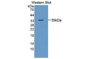 Detection of Recombinant Ki67P, Mouse using Polyclonal Antibody to Ki-67 Protein (Ki-67) (Ki-67 抗体  (AA 1-247))