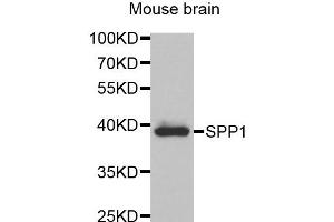 Western blot analysis of extracts of Mouse brain tissue, using SPP1 antibody. (Osteopontin 抗体)