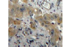 Used in DAB staining on fromalin fixed paraffin-embedded Liver tissue (PLGF 抗体  (AA 43-162))