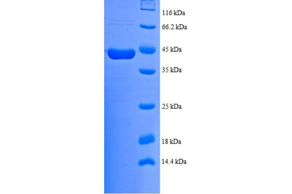 NDUFB7 Protein (AA 2-137) (GST tag)