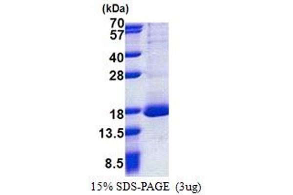 RPL30 Protein (AA 1-115) (His tag)