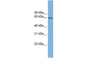 Human Heart; WB Suggested Anti-C8orf45 Antibody Titration: 0. (C8orf45 抗体  (Middle Region))