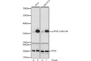 Western blot analysis of extracts of various cell lines using Phospho-RPS6(S240/244) Polyclonal Antibody at dilution of 1:1000. (RPS6 抗体  (pSer240, pSer244))