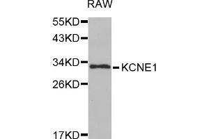 Western blot analysis of extracts of RAW264. (KCNE1 抗体)