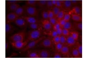 Image no. 2 for anti-Epidermal Growth Factor Receptor (EGFR) (AA 1068-1072) antibody (ABIN197228) (EGFR 抗体  (AA 1068-1072))