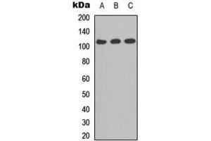 Western blot analysis of CD41 LC 1 expression in A549 (A), MCF7 (B), PC12 (C) whole cell lysates. (CD41 LC 1 (C-Term) 抗体)