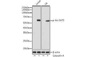 Western blot analysis of extracts of various cell lines, using Phospho-Akt-S473 antibody (ABIN7265522) at 1:1000 dilution. (AKT 1/2/3 抗体  (pSer472))