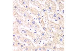 Immunohistochemistry of paraffin-embedded human liver injury using PSMF1 antibody (ABIN5973235) at dilution of 1/100 (40x lens). (PSMF1 抗体)