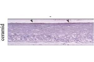 Sections of 3D organotypic skin equivalents were stained for ceramide. (Ceramide 抗体)