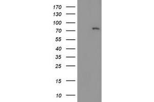 LIM Domain Kinase 1 抗体